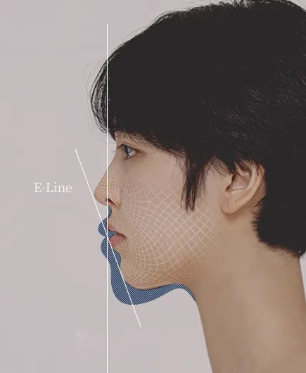 sub0202 img03 — 루센트치과의원